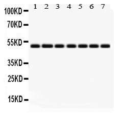 1 - Anti-IDH2 Picoband Antibody ABO12288