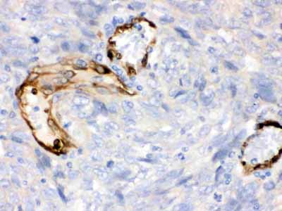 2 - Anti-IDO1 Picoband Antibody ABO12289