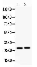 1 - Anti-IGFBP-1 Antibody ABO12290
