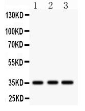 1 - Anti-IGFBP2 Picoband Antibody ABO12291