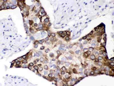 2 - Anti-KIN Picoband Antibody ABO12293