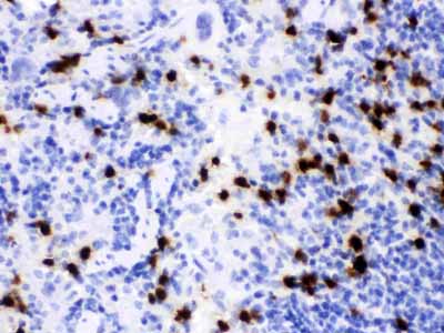 2 - Anti-Lipocalin-2/NGAL Antibody ABO12294