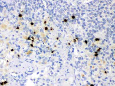 2 - Anti-Lipocalin-2/NGAL Antibody ABO12294