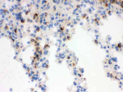 2 - Anti-Lipocalin-2/NGAL Antibody ABO12294