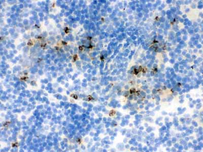 2 - Anti-Lipocalin-2/NGAL Antibody ABO12294