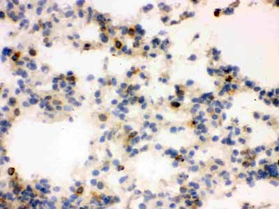 2 - Anti-Lipocalin-2/NGAL Antibody ABO12294