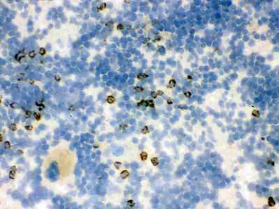 2 - Anti-Lipocalin-2/NGAL Antibody ABO12294