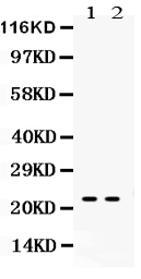 1 - Anti-Lipocalin-2/NGAL Antibody ABO12294