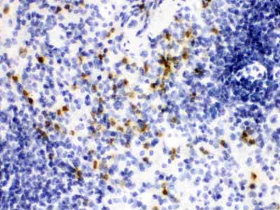 2 - Anti-Lipocalin-2/NGAL Antibody ABO12295