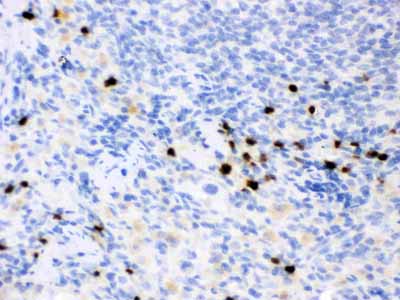 2 - Anti-Lipocalin-2/NGAL Antibody ABO12295