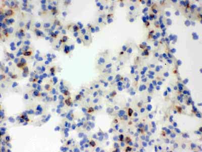 2 - Anti-Lipocalin-2/NGAL Antibody ABO12295