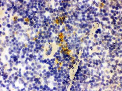 2 - Anti-Lipocalin-2/NGAL Antibody ABO12295