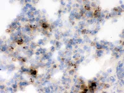 2 - Anti-Lipocalin-2/NGAL Antibody ABO12295