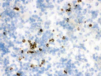 2 - Anti-Lipocalin-2/NGAL Antibody ABO12295