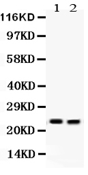 1 - Anti-Lipocalin-2/NGAL Antibody ABO12295