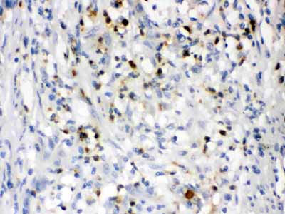 2 - Anti-Lipocalin-2/NGAL Antibody ABO12296
