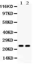 1 - Anti-Lipocalin-2/NGAL Antibody ABO12296