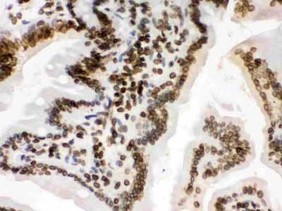 2 - Anti-Lamin B1 Picoband Antibody ABO12297