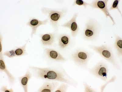 2 - Anti-Lamin B1 Picoband Antibody ABO12297