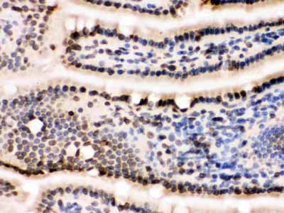 2 - Anti-Lamin B1 Picoband Antibody ABO12297