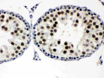 2 - Anti-MNAT1 Picoband Antibody ABO12300
