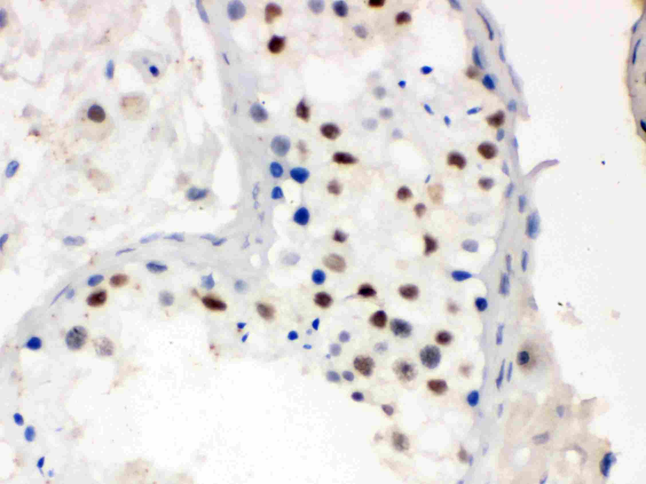 2 - Anti-MNAT1 Picoband Antibody ABO12300