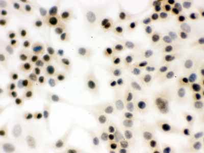 2 - Anti-p95 NBS1 Picoband Antibody ABO12301