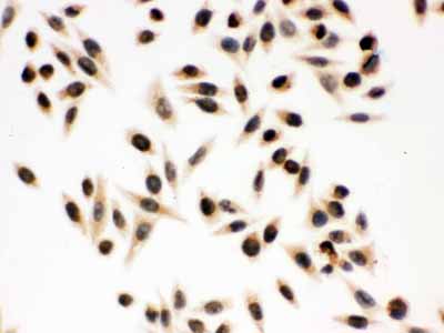 2 - Anti-p95 NBS1 Picoband Antibody ABO12301