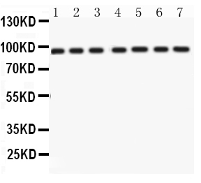 1 - Anti-p95 NBS1 Picoband Antibody ABO12301