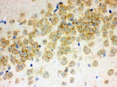 2 - Anti-Otoferlin Picoband Antibody ABO12302