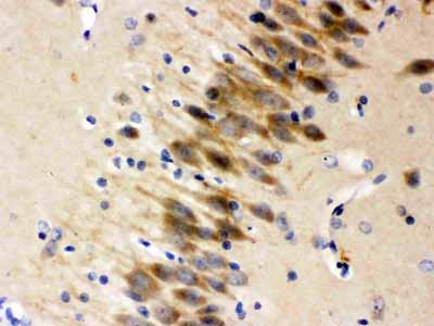 2 - Anti-Otoferlin Picoband Antibody ABO12302