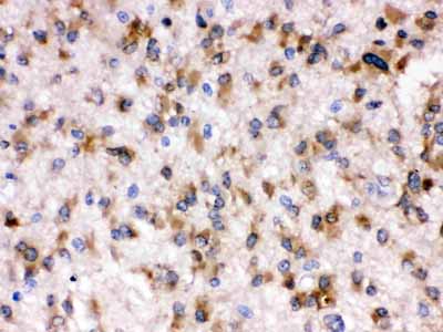 2 - Anti-Otoferlin Picoband Antibody ABO12302