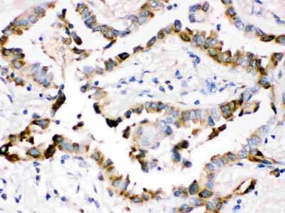 2 - Anti-SP-D Antibody ABO12303