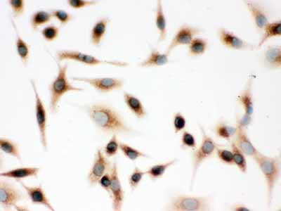 2 - Anti-SP-D Antibody ABO12303