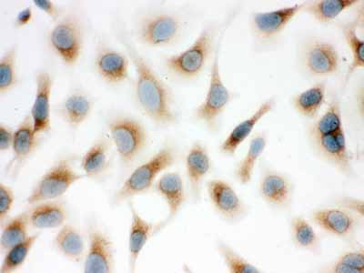 2 - Anti-SP-D Antibody ABO12303