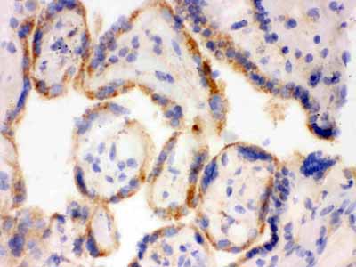 2 - Anti-SP-D Antibody ABO12303