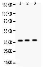 1 - Anti-SP-D Antibody ABO12303