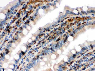 2 - Anti-Cofilin Picoband Antibody ABO12306