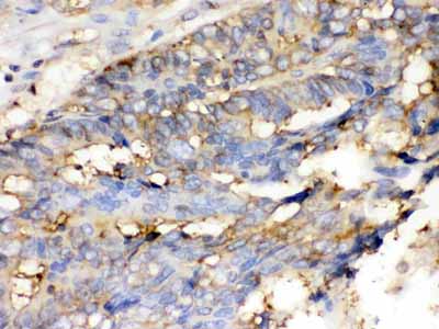 2 - Anti-Cofilin Picoband Antibody ABO12306