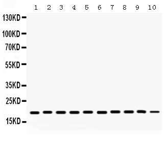 1 - Anti-Cofilin Picoband Antibody ABO12306