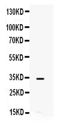 1 - Anti-IL-8 Picoband Antibody ABO12307