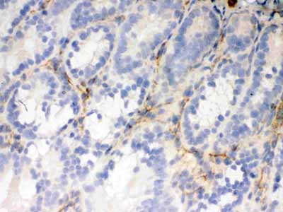 2 - Anti-Flotillin 2 Picoband Antibody ABO12309
