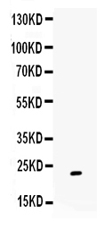 1 - Anti-Gremlin 1 Picoband Antibody ABO12312