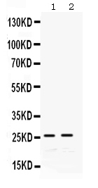 1 - Anti-GSTA1/A2/A3/A4/A5 Picoband Antibody ABO12313