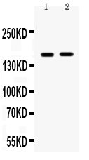 1 - Anti-HDAC6 Picoband Antibody ABO12314