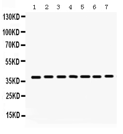 1 - Anti-HDAC11 Picoband Antibody ABO12316