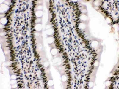 2 - Anti-HMG4 Picoband Antibody ABO12319