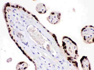 2 - Anti-HMG4 Picoband Antibody ABO12319