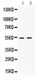 1 - Anti-HSF4 Picoband Antibody ABO12320