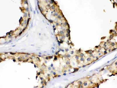 2 - Anti-Hsp90 Alpha Picoband Antibody ABO12321